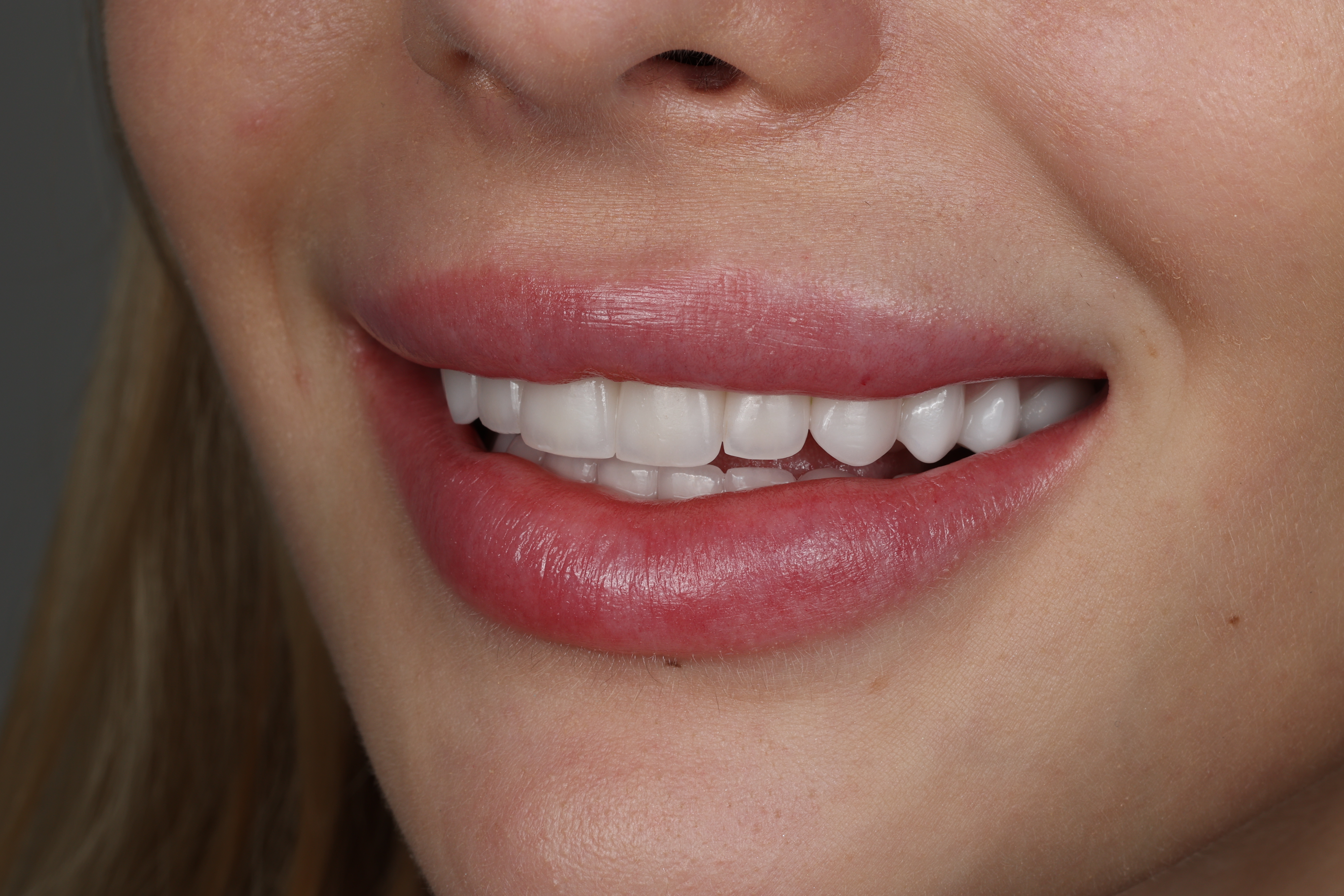Smile story andrii