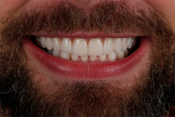 Smile story andrii