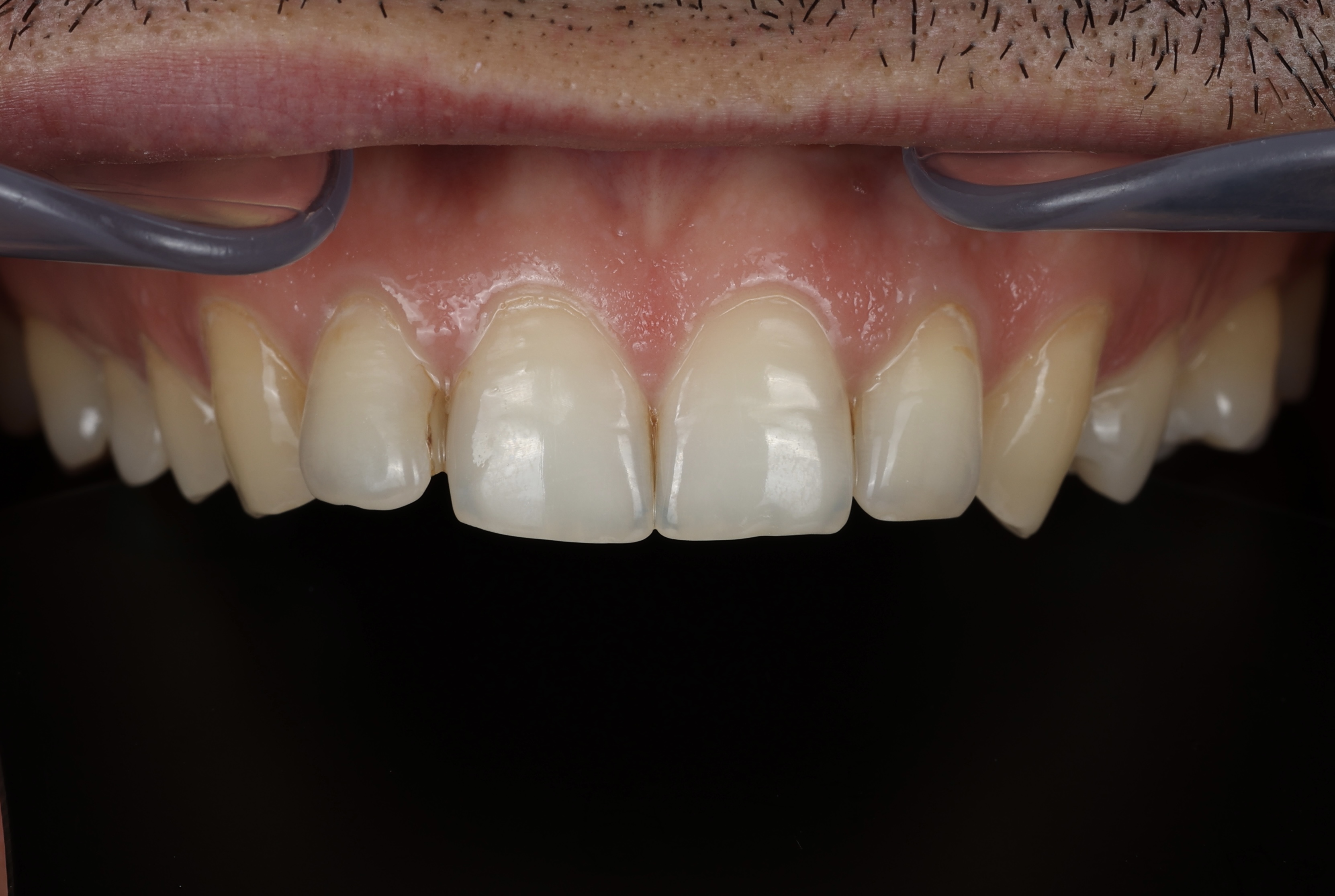 Smile story andrii
