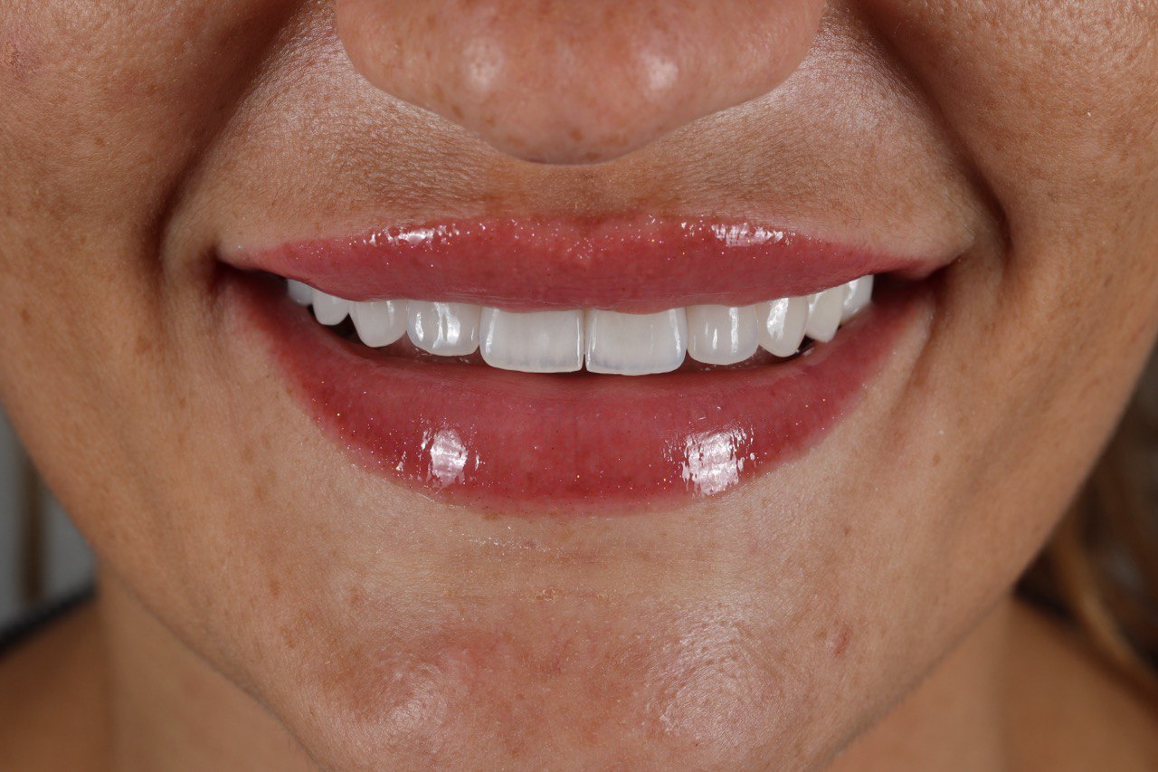Smile story andrii