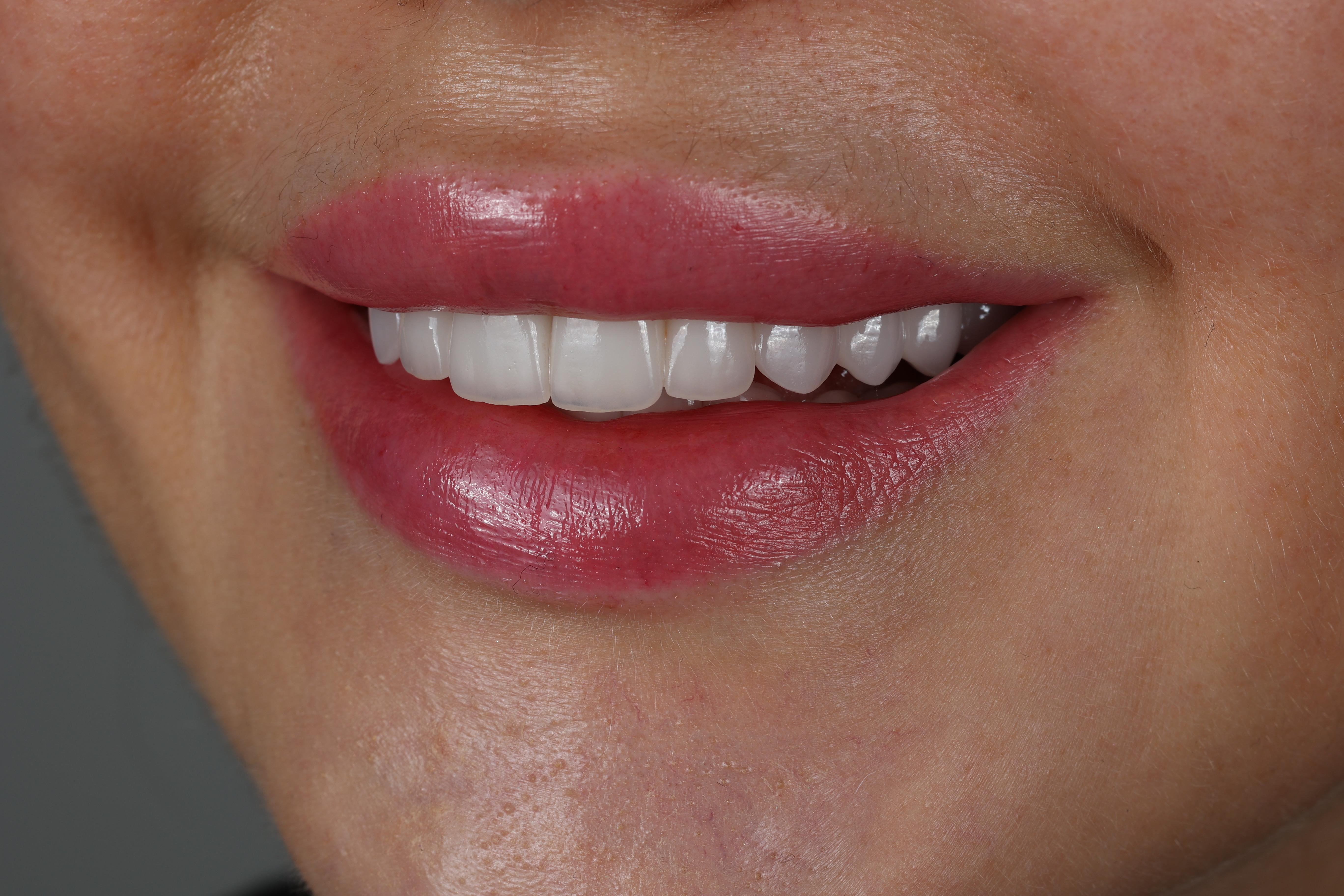 Smile story andrii